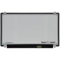 15.6 Inch LCD Scherm 1920x1080 Mat 40Pin