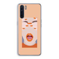 Surprise: Oppo A91 Transparant Hoesje