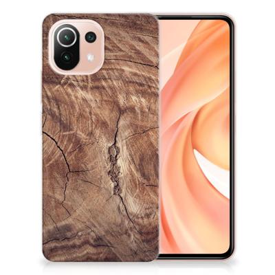 Xiaomi Mi 11 Lite | 11 Lite 5G NE | Bumper Hoesje | Tree Trunk