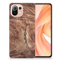 Xiaomi Mi 11 Lite | 11 Lite 5G NE | Bumper Hoesje | Tree Trunk