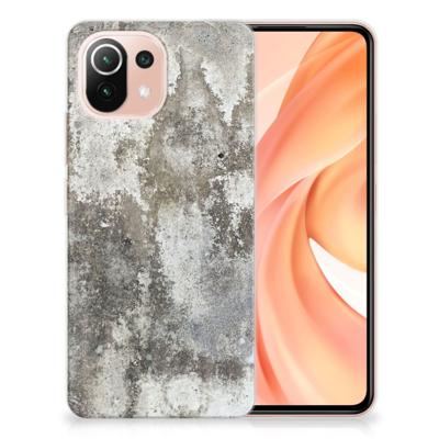 Xiaomi Mi 11 Lite | 11 Lite 5G NE | TPU | Siliconen hoesje | Beton Print