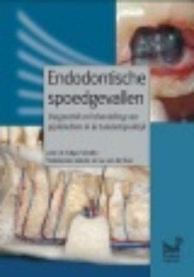 Endodontische spoedgevallen (Hardback)
