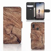 Huawei P20 Lite | Book Style Case | Tree Trunk
