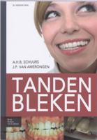 Tanden bleken (Paperback)
