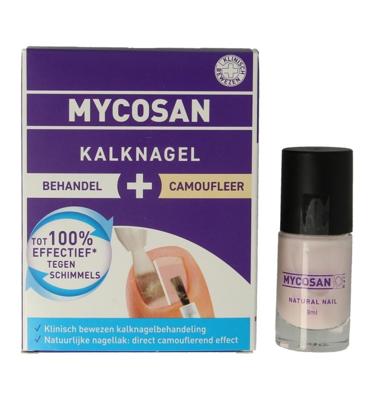Kalknagel behandel & camoufleer