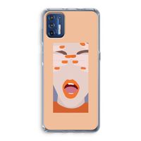 Surprise: Motorola Moto G9 Plus Transparant Hoesje