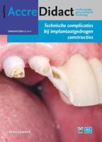 Technische complicaties bij implantaatgedragen constructies (Paperback)