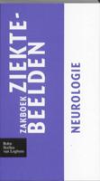 Zakboek ziektebeelden (Paperback)