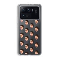 Ugly Cry Call: Xiaomi Mi 11 Ultra Transparant Hoesje