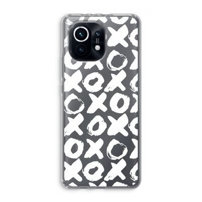 XOXO: Xiaomi Mi 11 Transparant Hoesje