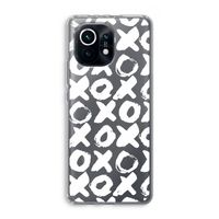 XOXO: Xiaomi Mi 11 Transparant Hoesje