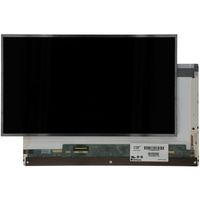OEM 15.6 inch LCD Scherm 1920x1080 Glans 40Pin