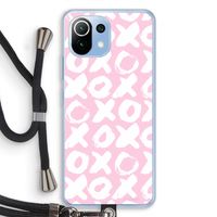 XOXO: Xiaomi Mi 11 Lite Transparant Hoesje met koord