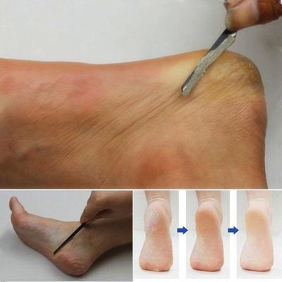 Pedicure Manicure Nail Cleaner Cuticle Grooming dode huid Planer schoonheid voet verzorging Tool