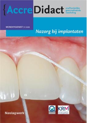 Nazorg bij implantaten (Paperback)