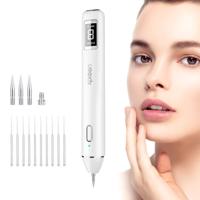 Xpreen Professional donkere vlek Remover sproet Tattoo ten laste wrat Mole Remover met LED scherm en Spotlight(Tarnish)