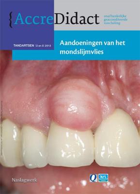 Aandoeningen van het mondslijmvlies (Paperback)