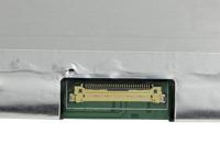 15.6 Inch LCD Scherm 1920x1080 Mat 30Pin eDP