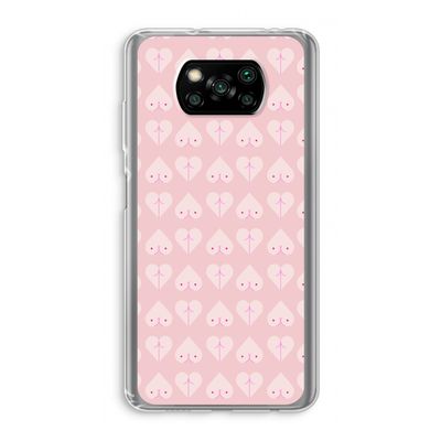 Ass 'n Titties: Xiaomi Poco X3 NFC Transparant Hoesje