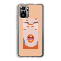 Surprise: Xiaomi Redmi Note 10S Transparant Hoesje
