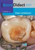 Diepe carieslaesies (Paperback)