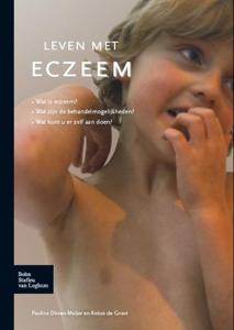 Leven met eczeem (Paperback)