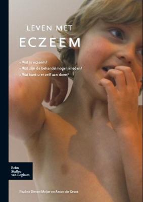 Leven met eczeem (Paperback)