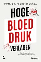 Hoge bloeddruk verlagen (Paperback) Hoge bloeddruk verlagen (Paperback)
