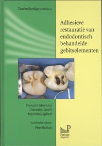Adhesieve restauratie van endodontisch behandelde gebitselementen (Hardback)