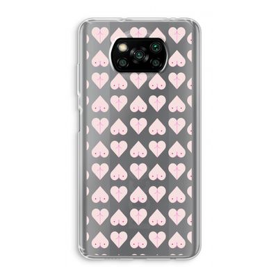 Ass 'n Titties: Xiaomi Poco X3 NFC Transparant Hoesje