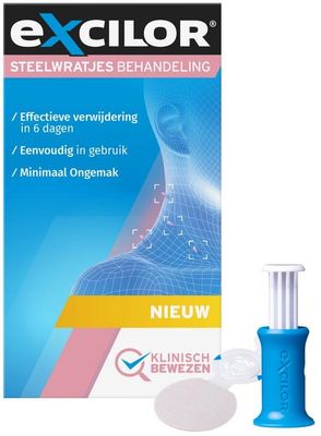 Steelwratjes