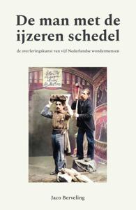 De man met de ijzeren schedel (Paperback)