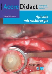 Apicale microchirurgie - Fenneke Dommering - Paperback (9789089763600)