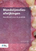 Mondslijmvliesafwijkingen (Paperback) Mondslijmvliesafwijkingen (Paperback)