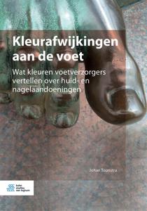 Kleurafwijkingen aan de voet (Paperback)