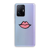 Kusje: Xiaomi 11T Transparant Hoesje