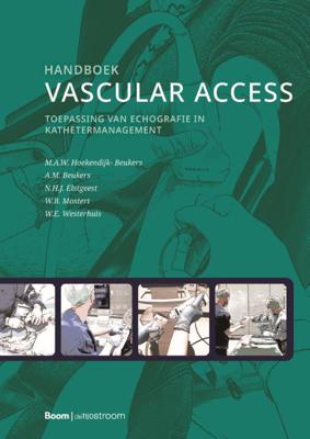 Handboek vascular access (Paperback)