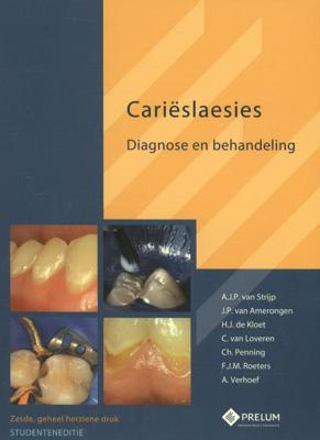 Carieslaesies-studenteneditie (Paperback)
