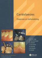 Carieslaesies-studenteneditie (Paperback)