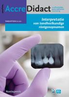 Interpretatie van tandheelkundige röntgenopnamen (Paperback) Interpretatie van tandheelkundige röntgenopnamen (Paperback)