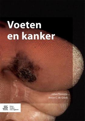 Voeten en kanker (Paperback)
