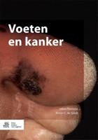 Voeten en kanker (Paperback)