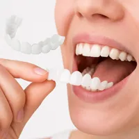 Deepsleep Snapon Smile Nep tanden boven en onder - Witte tanden