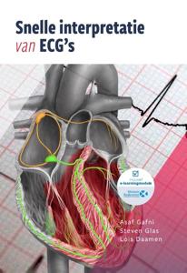 Snelle interpretatie van ECG&apos;s (Paperback)