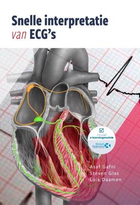 Snelle interpretatie van ECG&apos;s (Paperback)