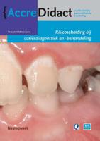 Risicoschatting bij cariësdiagnostiek en -behandeling gebaseerd op risicoschatting (Paperback)