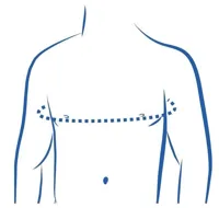 GO Medical Bovenrug Rugrechthouder - 1 - Zwart