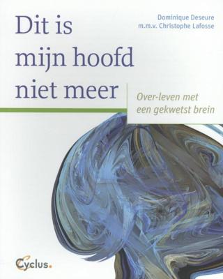 Dit is mijn hoofd niet meer (Paperback)
