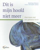 Dit is mijn hoofd niet meer (Paperback)