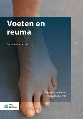 Voeten en reuma (Paperback)